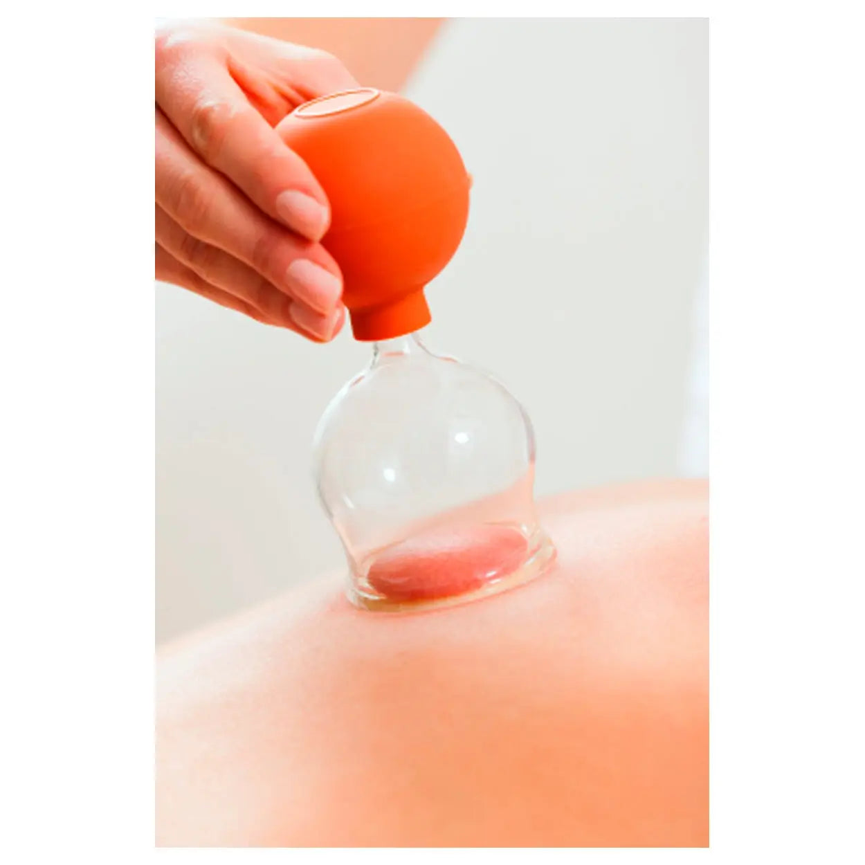 Schröpfkopf Sport-Tec in Anwendung