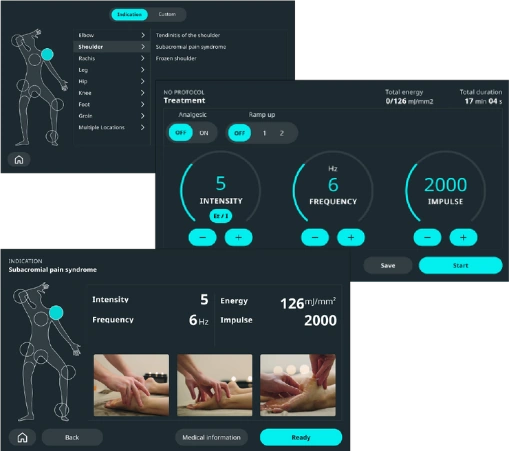 Digitale Parameteransichten des fokussierten Stoßwellengerät DOLORCLAST Focused Shock Waves