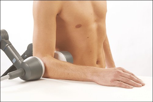 Anwendung des Diathermie-Gerät BTL-6000 Kurzwelle 200 am Ellbogen eines Mannes