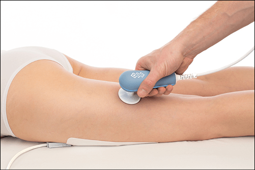 Radiofrequenztherapie Gerät BTL-6000 in Anwendung am Beinbeuger einer Frau auf einer Therapieliege
