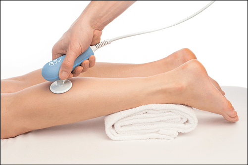 Radiofrequenztherapie Gerät BTL-6000 in Anwendung an der Wade einer Frau auf einer Therapieliege
