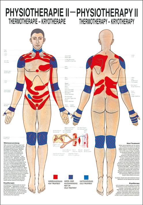 Thermotherapie-Tafel Rüdiger Physiotherapie II mit Vorder- und Rückseite des Körpers und Markierungen/Beschriftungen