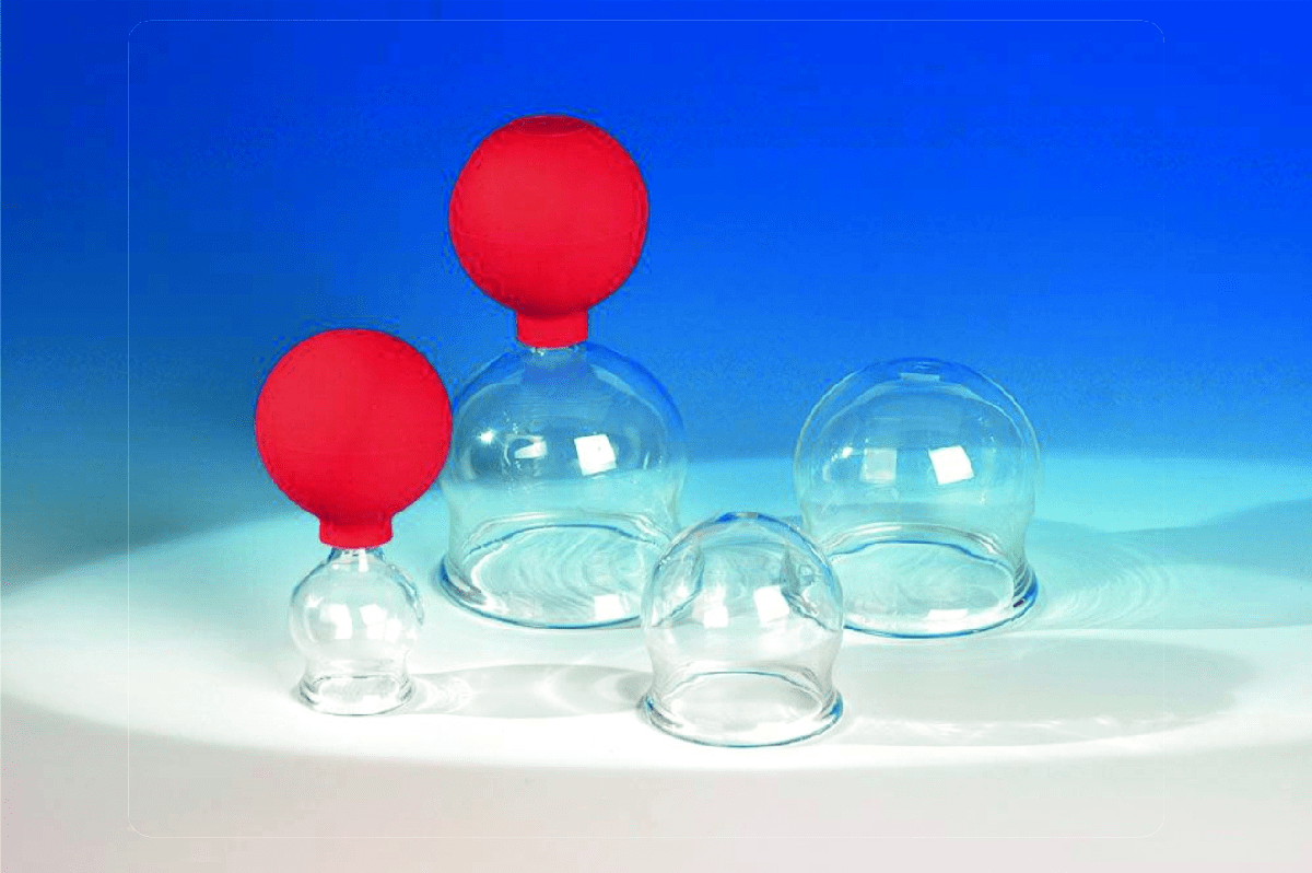 Vier Schröpfgläser aus Glas zum Feuerschröpfen in verschiedenen Größen, zwei davon mit Gummiball
