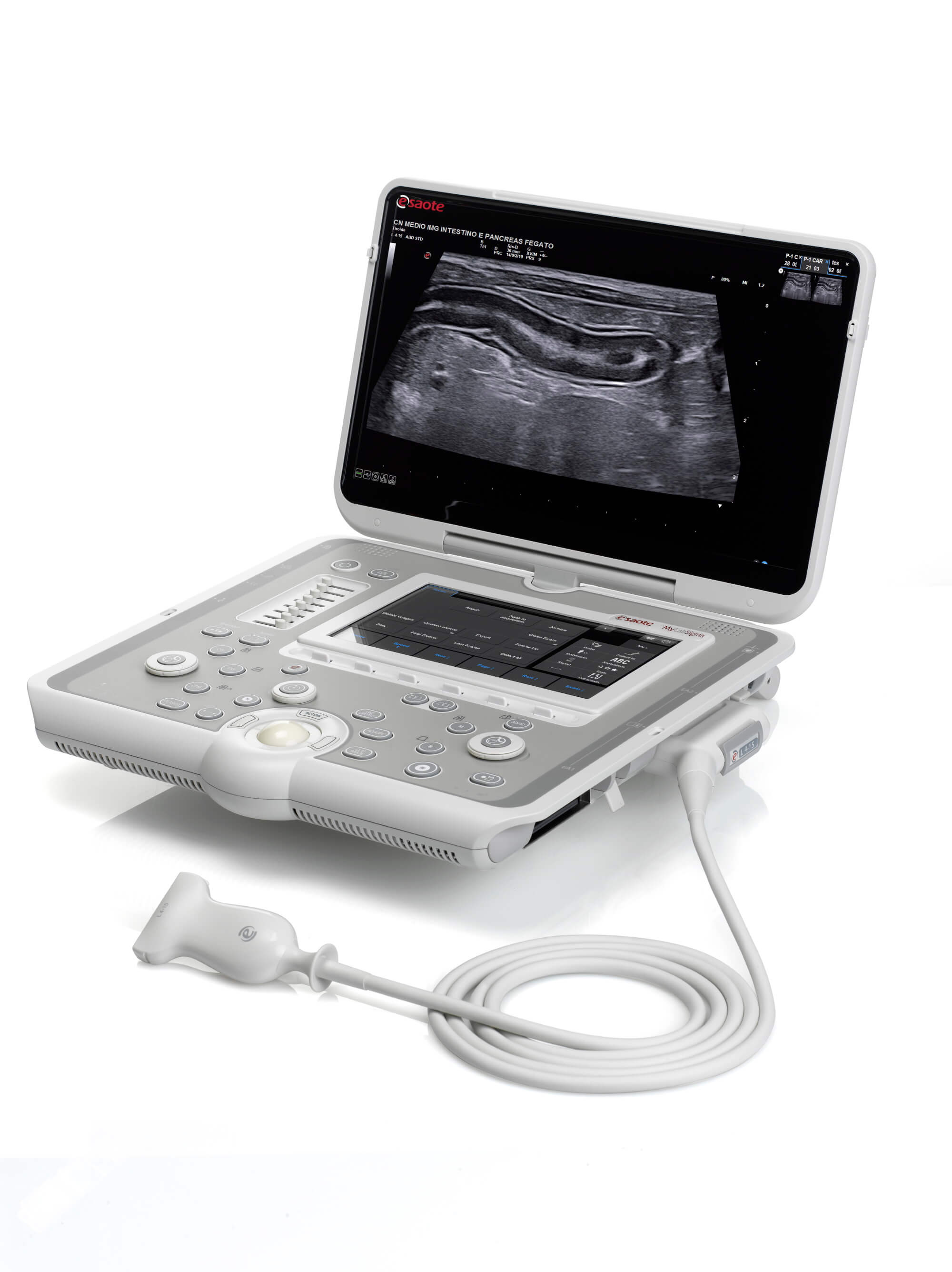 Sonographiegerät MyLab™Sigma mit Bildschirm und Kabelsonde
