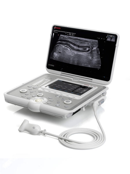 Sonographiegerät MyLab™Sigma tragbar mit 15,6 Zoll LED-Bildschirm