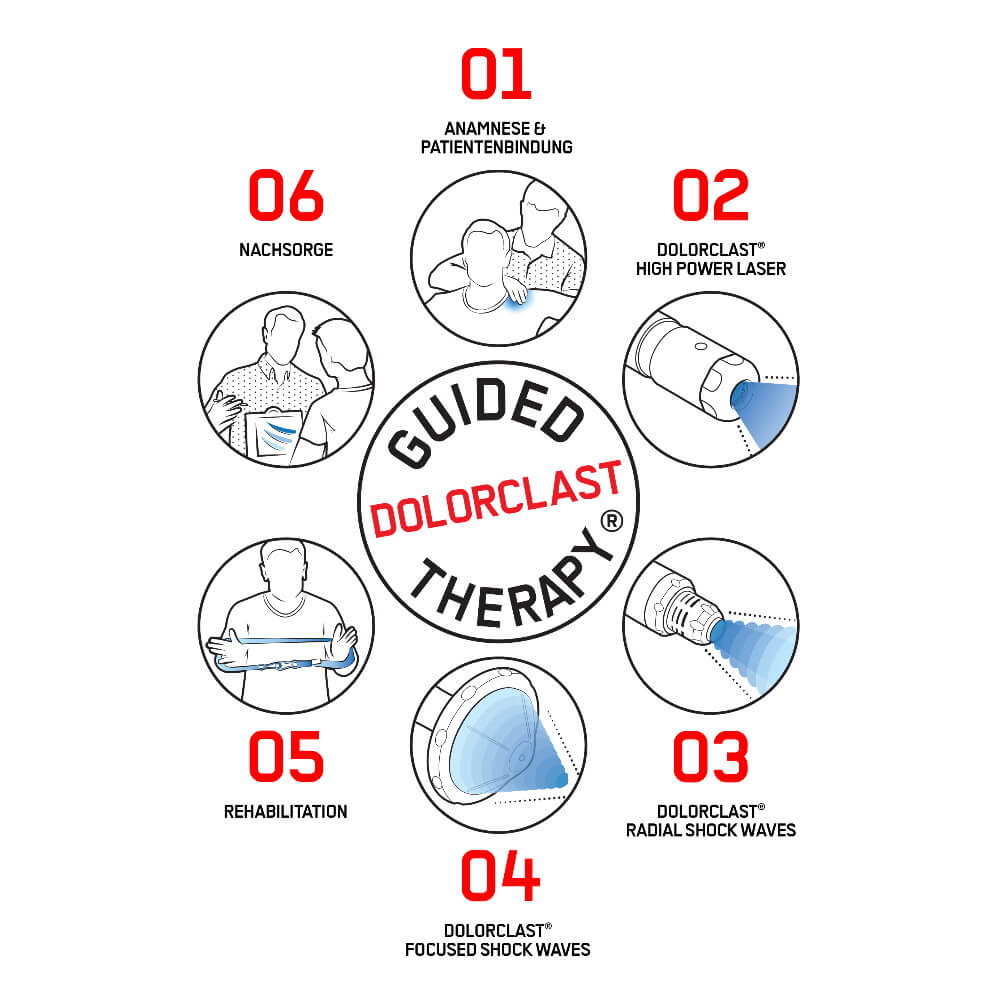 Therapieverfahren des Stoßwellengerät SWISS DOLORCLAST® Radial Shock Waves
