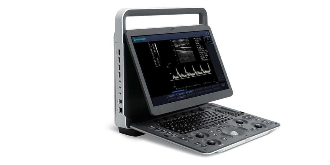 Sonographiegerät SonoScape E1 mit Display, Tastatur und weiteren Steuerknöpfen