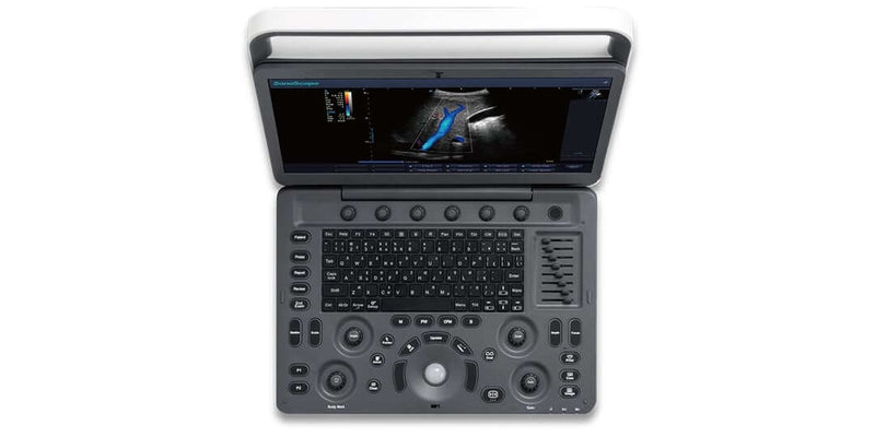 Sonographiegerät SonoScape E2 – Farb-Doppler-System